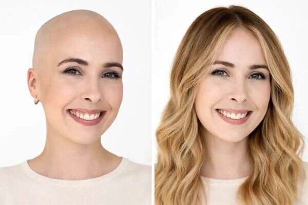 Woman confidently wearing medical wig