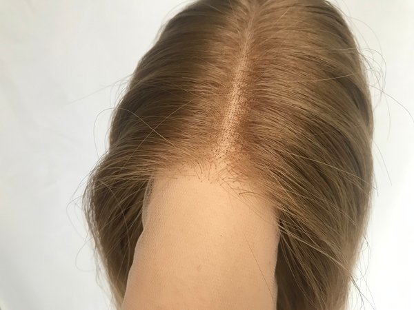 hairline density transition references